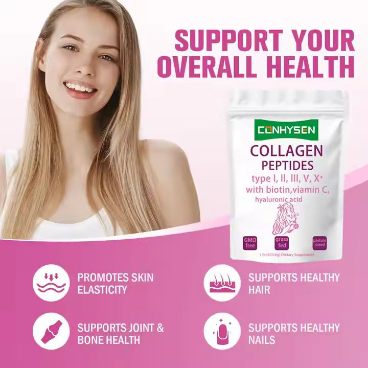Ergänzungen OEM Kollagenpeptide Pulver für Haut Haar Gelenkgesundheit unterstützt Anti-Aging