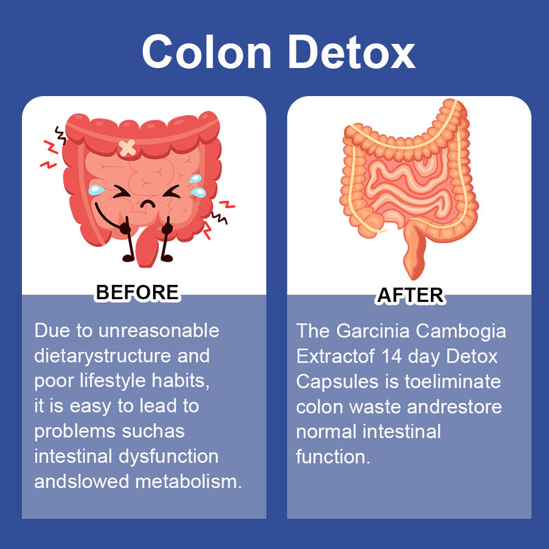 Private Label 14 Tage Slim Kapsel unterstützt Verdauungsgesundheit und Gewichtsverlust Nahrungsergänzungsmittel Detox Kapseln